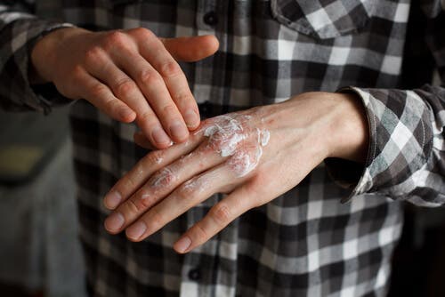 Pacient încercând aplicarea corticosteroizilor topici pe mâna sa
