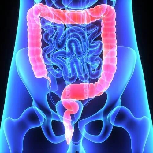 Simptome ale polipilor colorectali