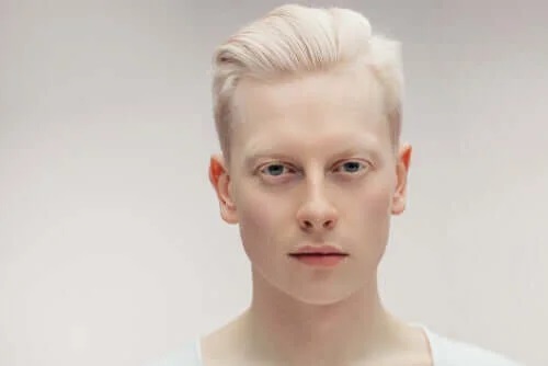 Ce este albinismul și de ce apare?