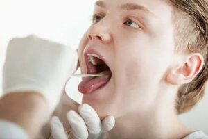 Glosodinia: sindromul gurii care arde