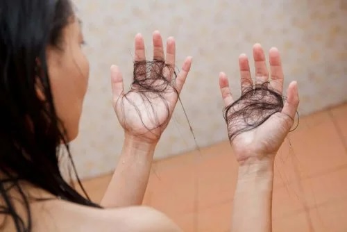 Femeie care se confruntă cu căderea părului la schimbarea anotimpului