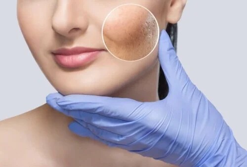 Dermatolog care folosește liftingul facial fără operație