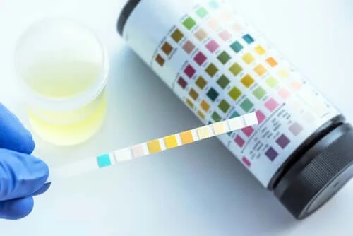 Ce poate fi detectat prin analiza urinei?