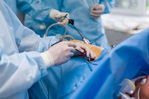 Echipă medicală efectuând o colostomie