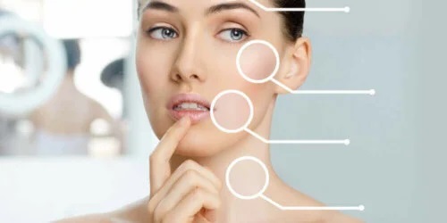 Fată care ia în calcul liftingul facial fără operație