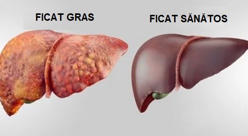 Ficat gras și ficat sănătos