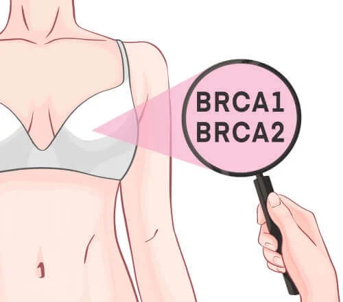 Genele BRCA-1 și BRCA-2 și cancerul de sân