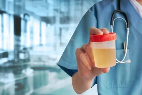 Medic care explică ce poate fi detectat prin analiza urinei
