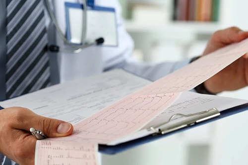 Medic care analizează efectele alcoolului asupra inimii