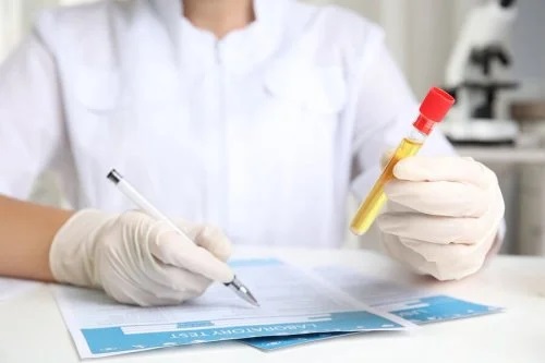 Medic care analizează o probă de urină