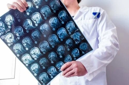 Medic care examinează rezultatul unui RMN