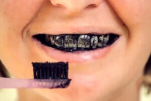 Riscurile cărbunelui activ pentru sănătatea orală