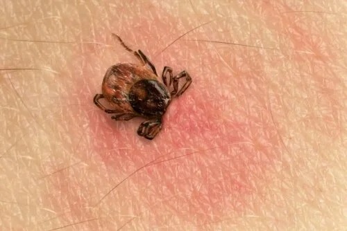 Persoană care are nevoie de tratament pentru boala Lyme
