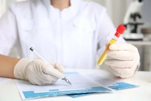 Doctor care prescrie tratamente pentru nivelul scăzut de creatinină