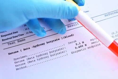 Analize ce indică prezența diabetului