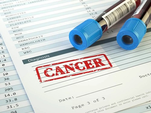 Analize care depistează prezența cancerului