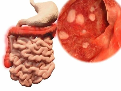 Bacterii prezente în intestine