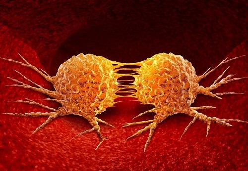 Cum se dezvoltă cancerul în celule