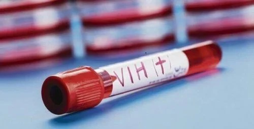 Sângele unui pacient cu HIV vindecat