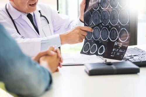 Glutenul provoacă boli neurologice?
