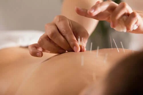 Medic ce aplică terapia dry needling