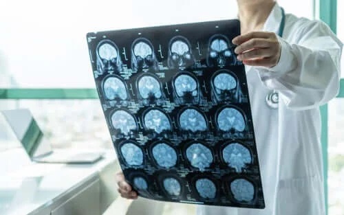 Medic care caută un tratament pentru encefalită