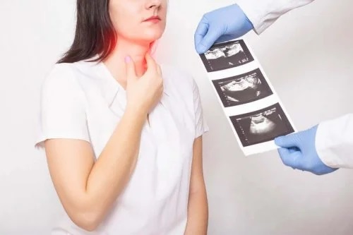 Simptomele și tratamentele cancerului tiroidian