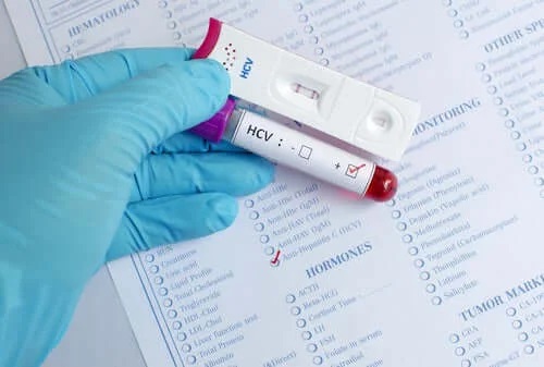 Medic care face analize de Ziua Mondială a Hepatitei