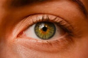 Nevi oculari: ce sunt pistruii oculari?