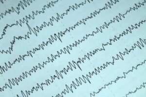 Cum să gestionezi epilepsia și alăptarea