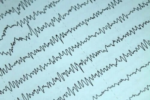 Cum să gestionezi epilepsia și alăptarea