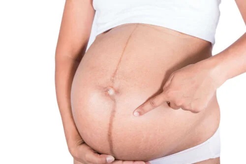 Femeie afectată de schimbările pielii în sarcină