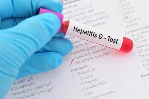 Test pentru mai multe tipuri de hepatită
