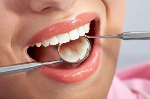 Verificarea dinților la stomatolog