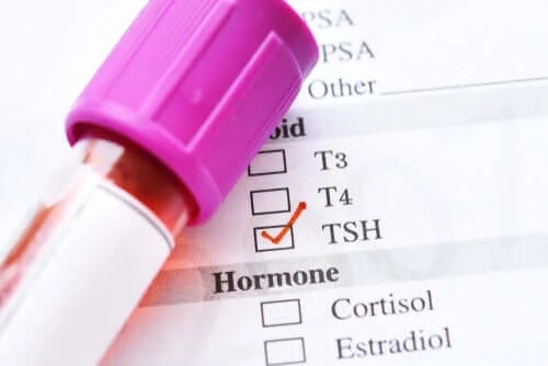 Hormonul de stimulare tiroidiană scăzut: cauze