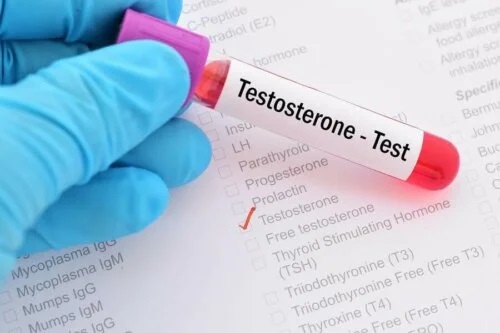 Analiza testosteronului