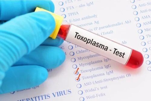 Analize necesare în tratamentul toxoplasmozei oculare