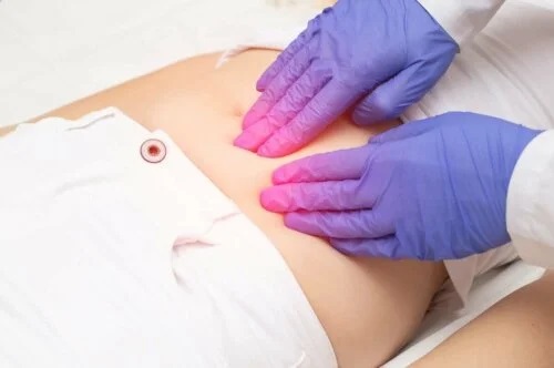 Doctor care diagnostichează endometrioza la menopauză