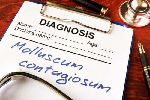 Ce este Molluscum contagiosum?