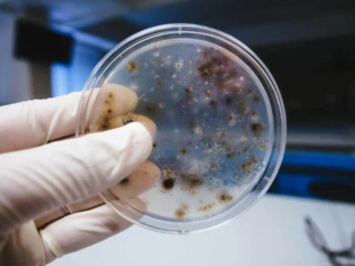 Medic care analizează ce sunt microbii