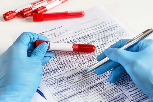 Medic care ia o probă de sânge