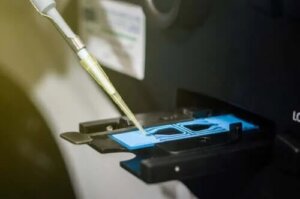 Cum se interpretează rezultatul unei spermograme