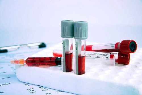Simptomele anemiei confirmate prin analize de sânge