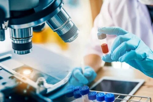 Simptomele infecției HIV analizate în laborator