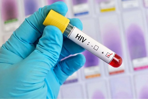 Test pentru depistarea virusului HIV