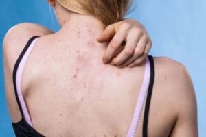 10 cauze și tipuri de erupții cutanate