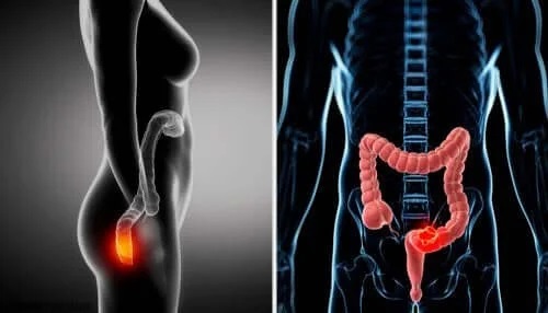 Ce este anoscopia utilizată pentru a studia rectul