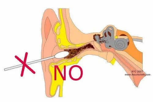 Cum să nu elimini dopurile de ceară din urechi
