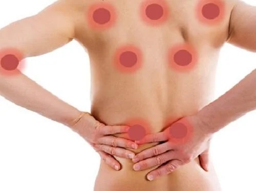Remedii pentru durerile musculare