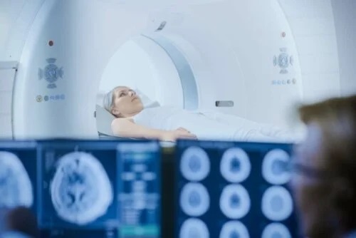 Femeie tratată cu radioterapie